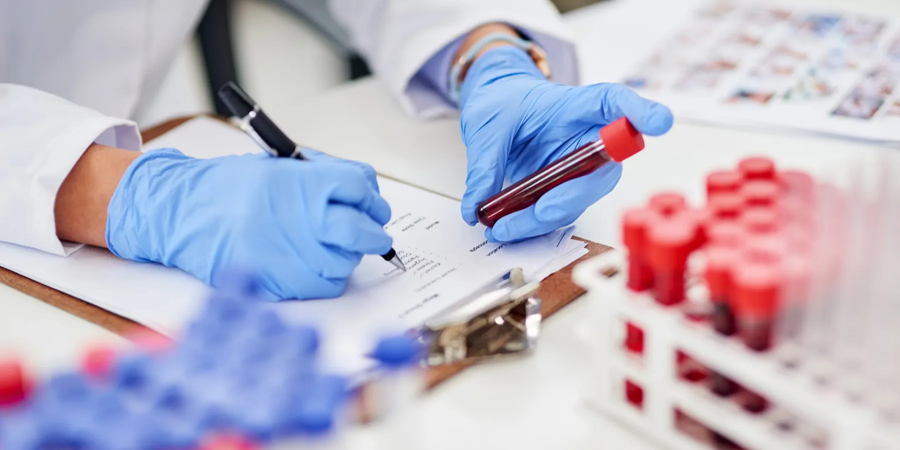 Clinical lab technician wearing gloves holding blood vial and writing something down