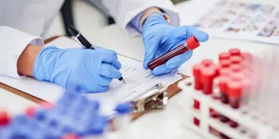 Clinical lab technician wearing gloves holding blood vial and writing something down