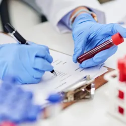 Clinical lab technician wearing gloves holding blood vial and writing something down