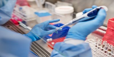 Lab personnel using a micropipette to carry out the Karius liquid biopsy test.