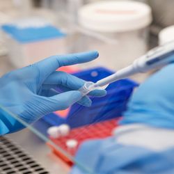Lab personnel using a micropipette to carry out the Karius liquid biopsy test.