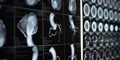 MRI images of heart and blood vessels 