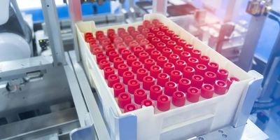 Robot arm in a clinical lab with test tubes for diagnostics assays.