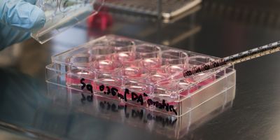 Photo of a stem cell culture dish in a clinical laboratory.