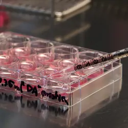 Photo of a stem cell culture dish in a clinical laboratory.