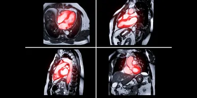 MRI images with sections highlighted in red