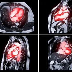 MRI images with sections highlighted in red
