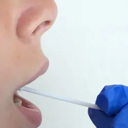 Person having their mouth swabed for a saliva test