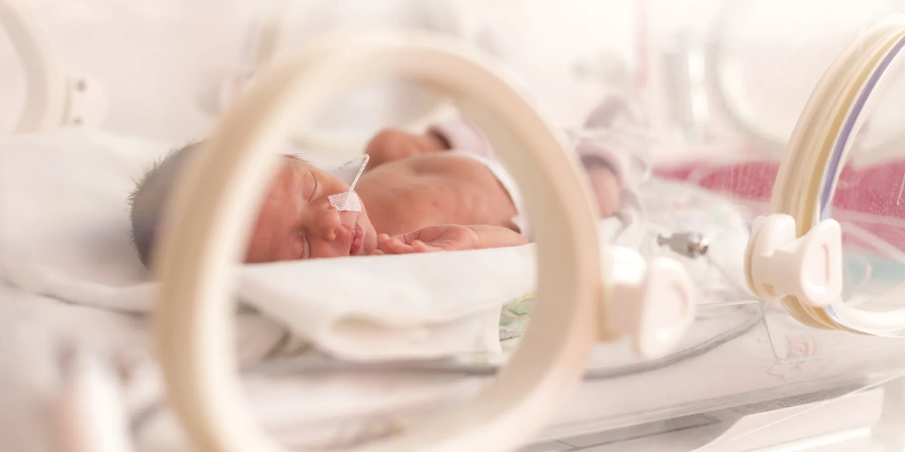 Preterm baby in an incubator being treated