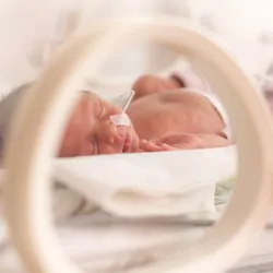 Preterm baby in an incubator being treated