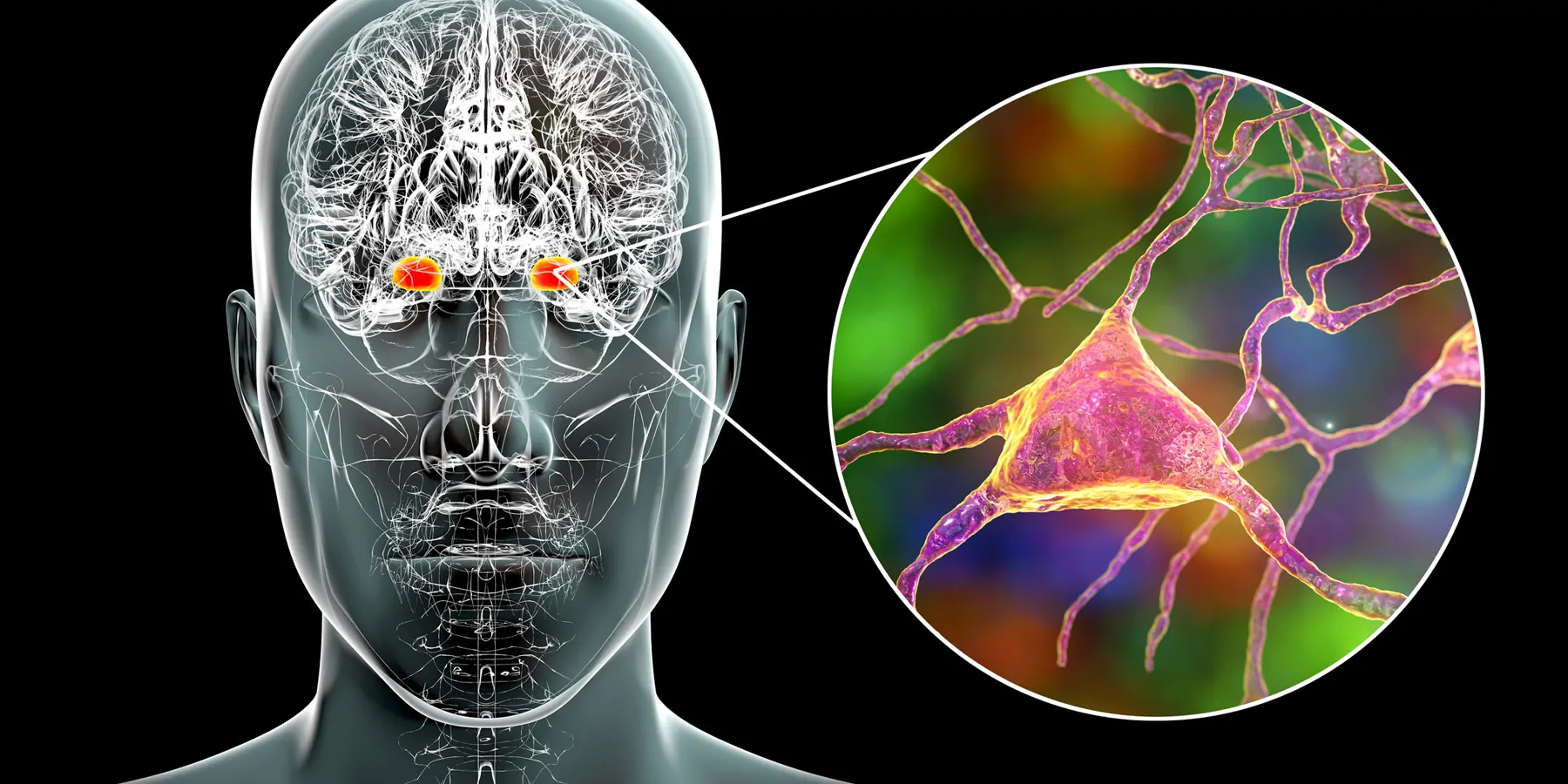 Human brain with the amygdala highlighted in red