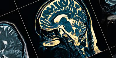 A brain scan of a human brain