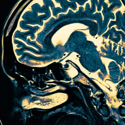 A brain scan of a human brain