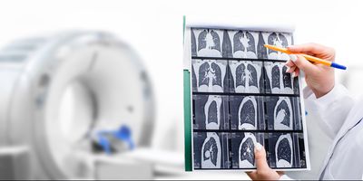 Health care professional looking at a CT scan of a persons chest