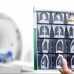 Health care professional looking at a CT scan of a persons chest