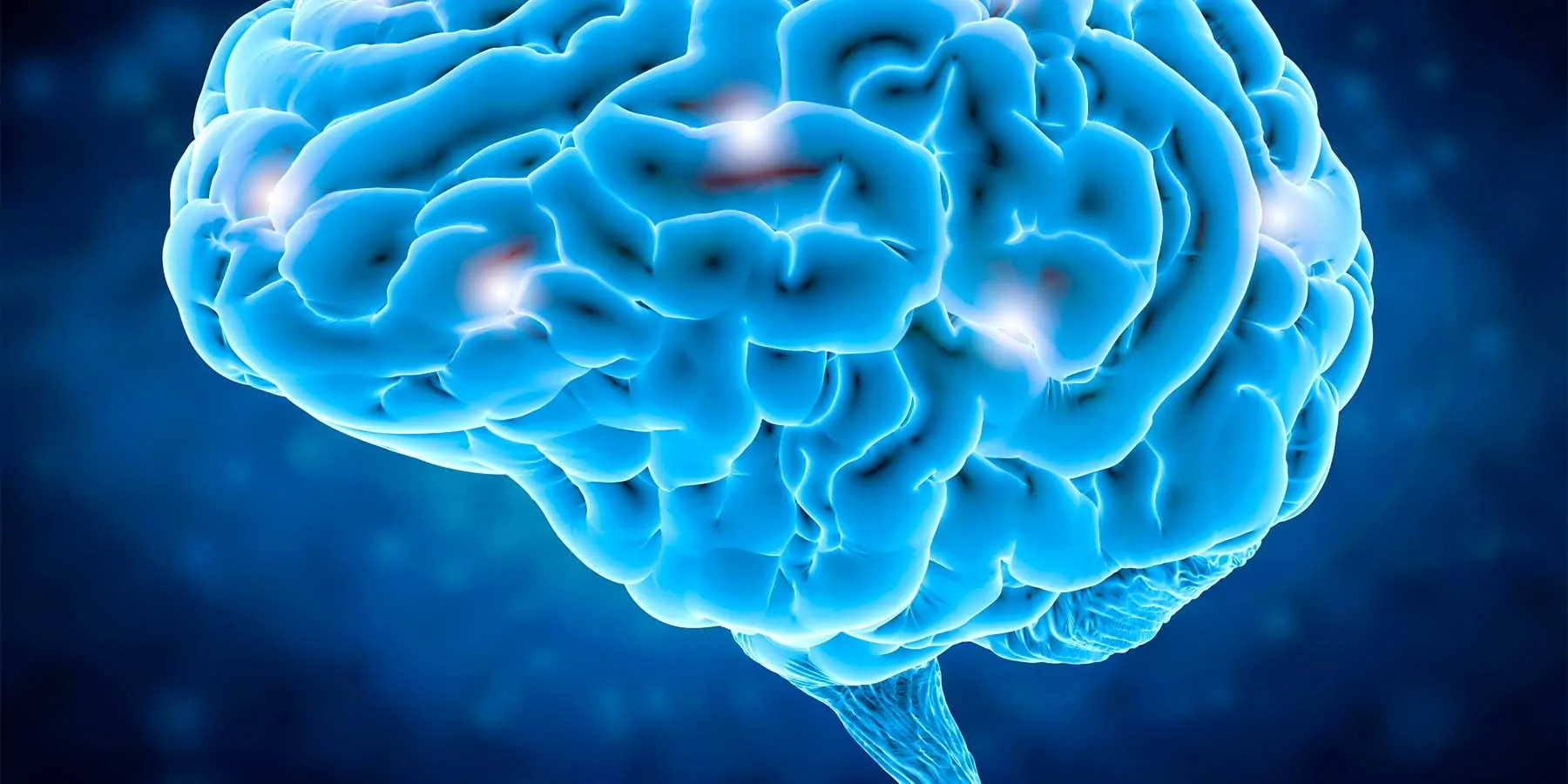 A computer model of a human brain in blue with highlighted spots to indicate damage