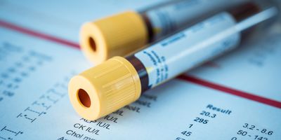 Blood vials laying on a sheet of paper