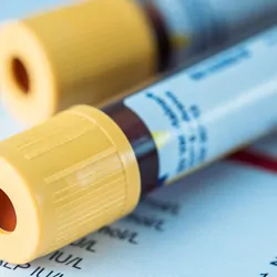 Blood vials laying on a sheet of paper