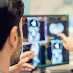 Medical professionals discuss the results of a radiotheranostics CT scan for a person with cancer.