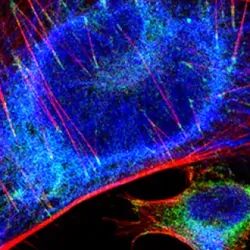Immunohistochemistry sample