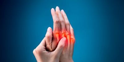 Person holding hand up with red marks on knuckles to indicate joint pain