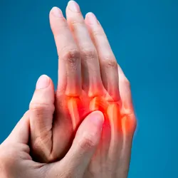 Person holding hand up with red marks on knuckles to indicate joint pain