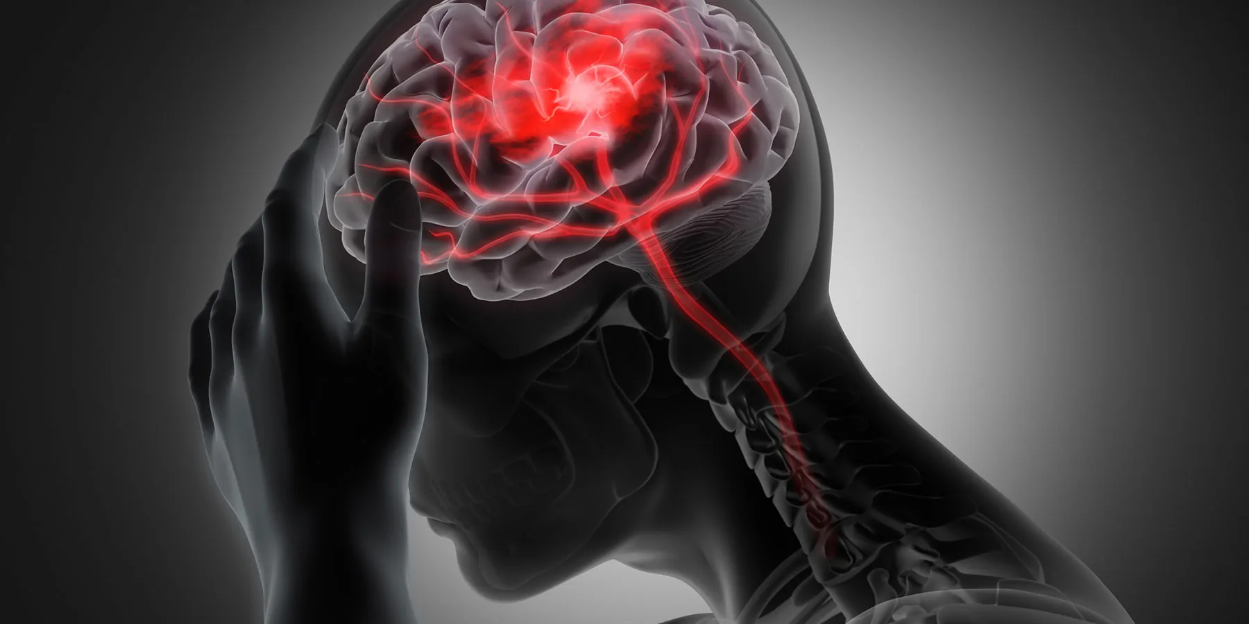 Man with heavy headache or brain stroke - conceptual artwork