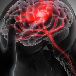 Man with heavy headache or brain stroke - conceptual artwork