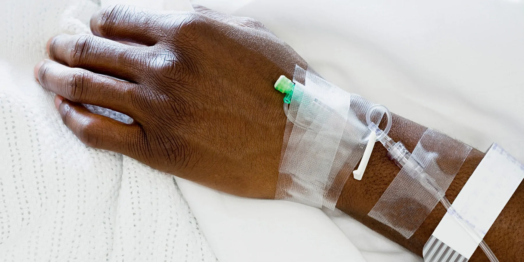Cancer Death Rates Remain Highest among Black Populations Arm of a patient with an IV in it
