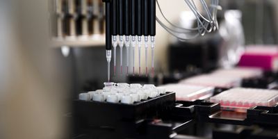 Photo of clinical lab supplies essential to coronavirus testing.