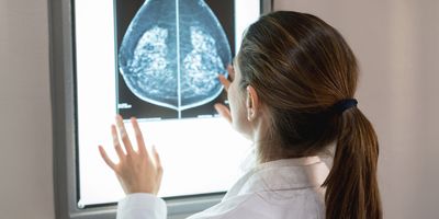 Female gynocologist looking at a patients mammogram at the hospital