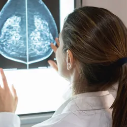 Female gynocologist looking at a patients mammogram at the hospital