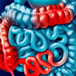 Computer image of a human intestine with red patches to indicate disease