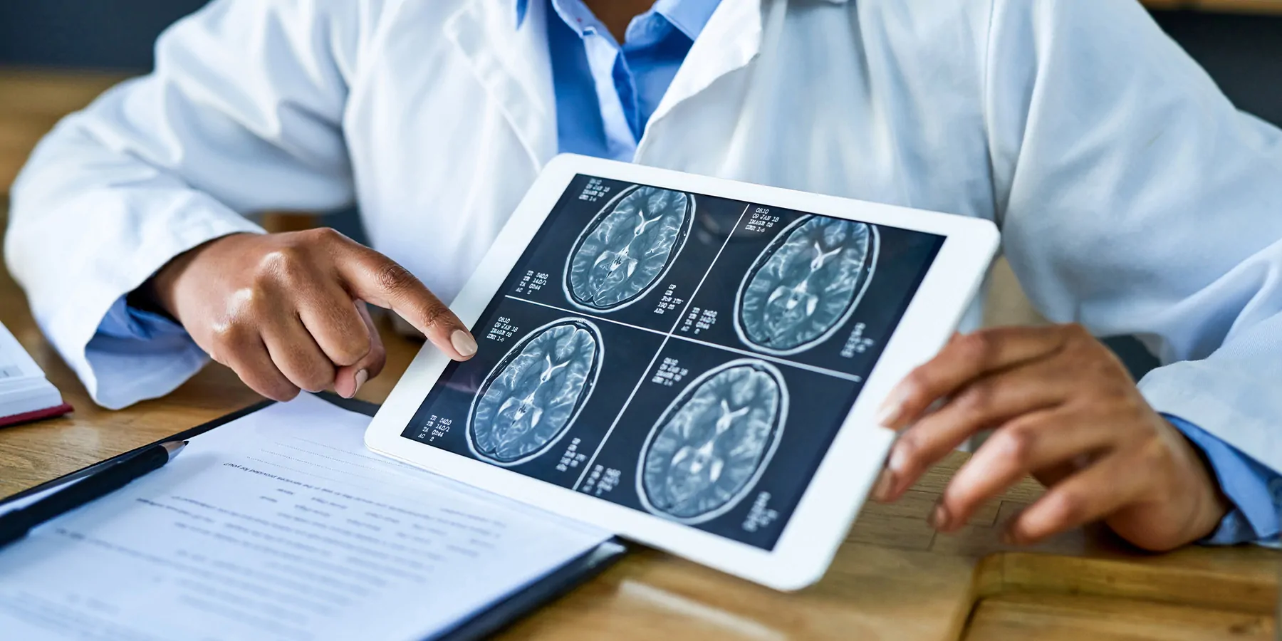 Doctor holding a brain scan on a tablet
