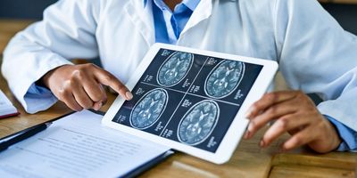 Doctor holding a brain scan on a tablet