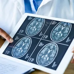 Doctor holding a brain scan on a tablet