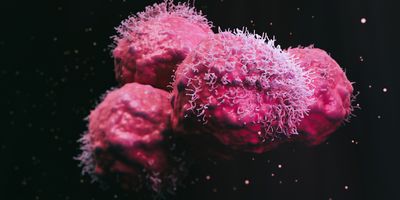 Computer image of pink cancer cells on a black background