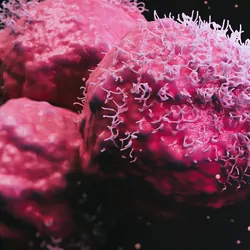 Computer image of pink cancer cells on a black background