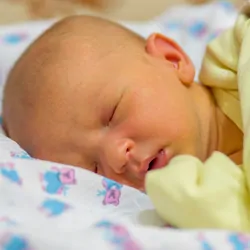 A newborn baby with jaundice, sleeping in a crib
