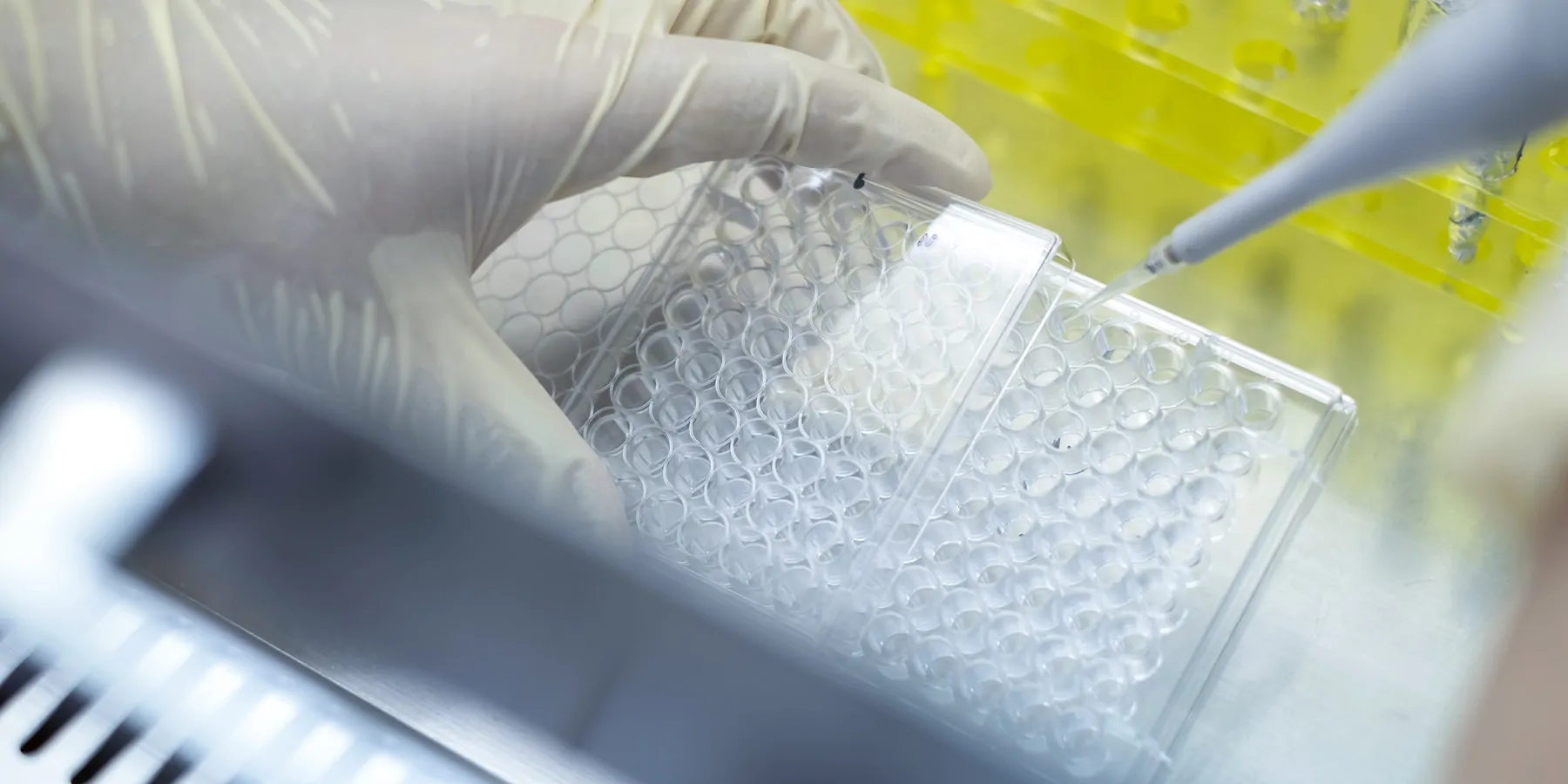 Photo of a clinical lab professional preparing a lab developed test.