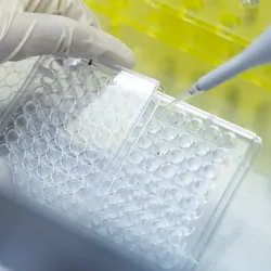 Photo of a clinical lab professional preparing a lab developed test.