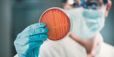 Researcher, wearing gloves, holding a petri dish with bacteria growing on it