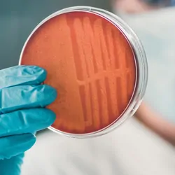 Researcher, wearing gloves, holding a petri dish with bacteria growing on it