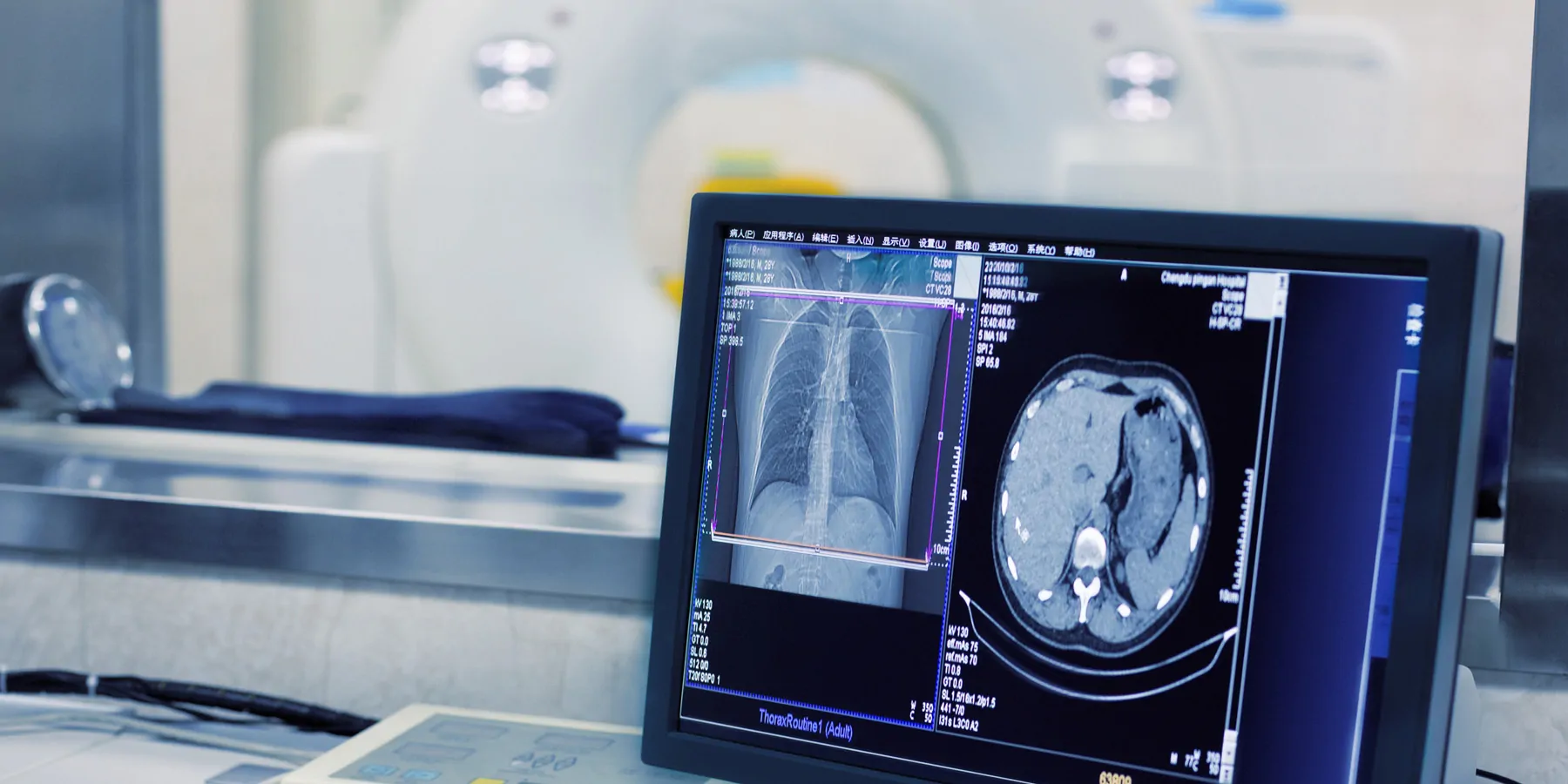 CT scaner and computer showing results
