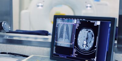 CT scaner and computer showing results