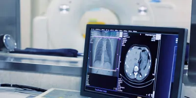 CT scaner and computer showing results