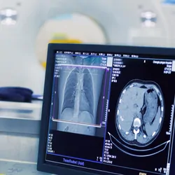 CT scaner and computer showing results