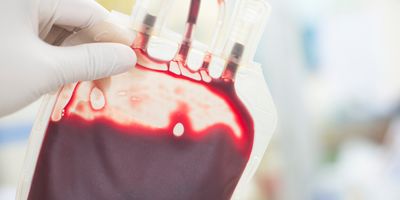 Photo of a clinical professional holding up a blood supply product.