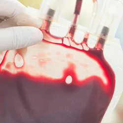 Photo of a clinical professional holding up a blood supply product.