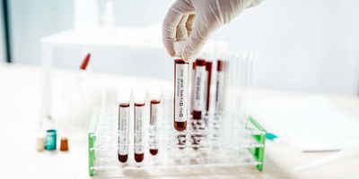 Gloved hand holding vials of blood for testing